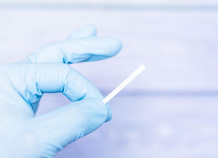 Test Strip Manufacturer Support hand in rubber glove holding test strip